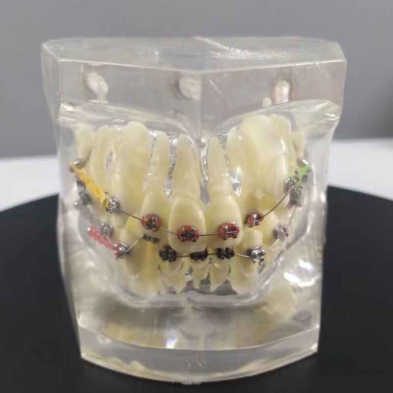Dental Typodont Orthodontic Treatment Malocclusion Study Model w Brackets Chain