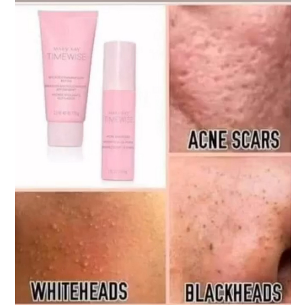 Mary Kay TimeWise Microdermabrasion Plus Set