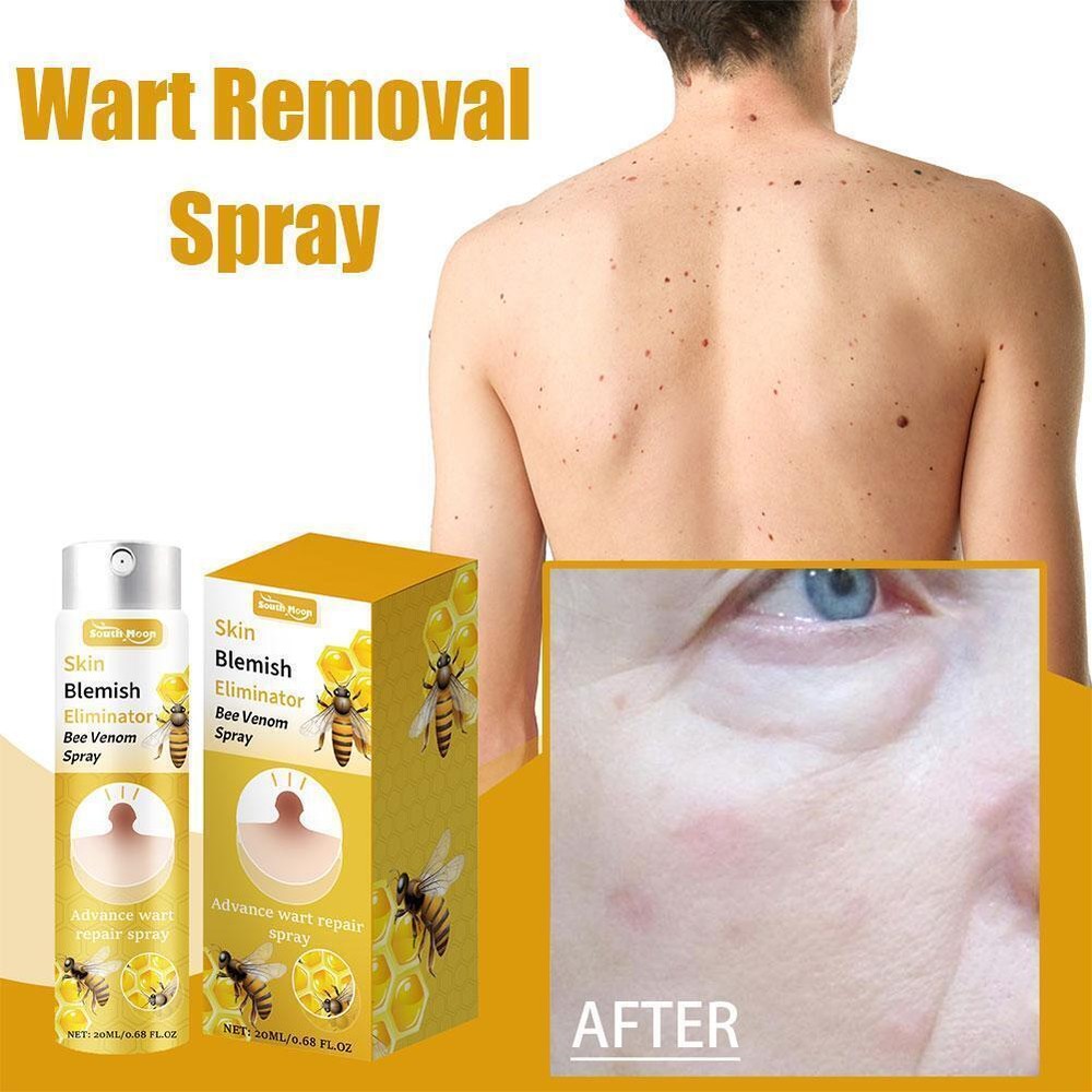 Tag Recede Bee Spray, Bee Warts and Button Removal Treatment/ ☆☆US