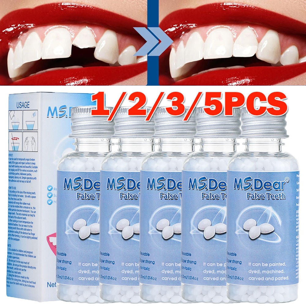 Tooth Repair Kit - Temporary Teeth Replacement Kit for Missing & Broken Teeth