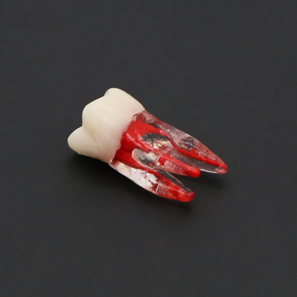 Dental Typodont Endodontic Practice Pulp-Opened RCT Root Canal Teeth Model M8008