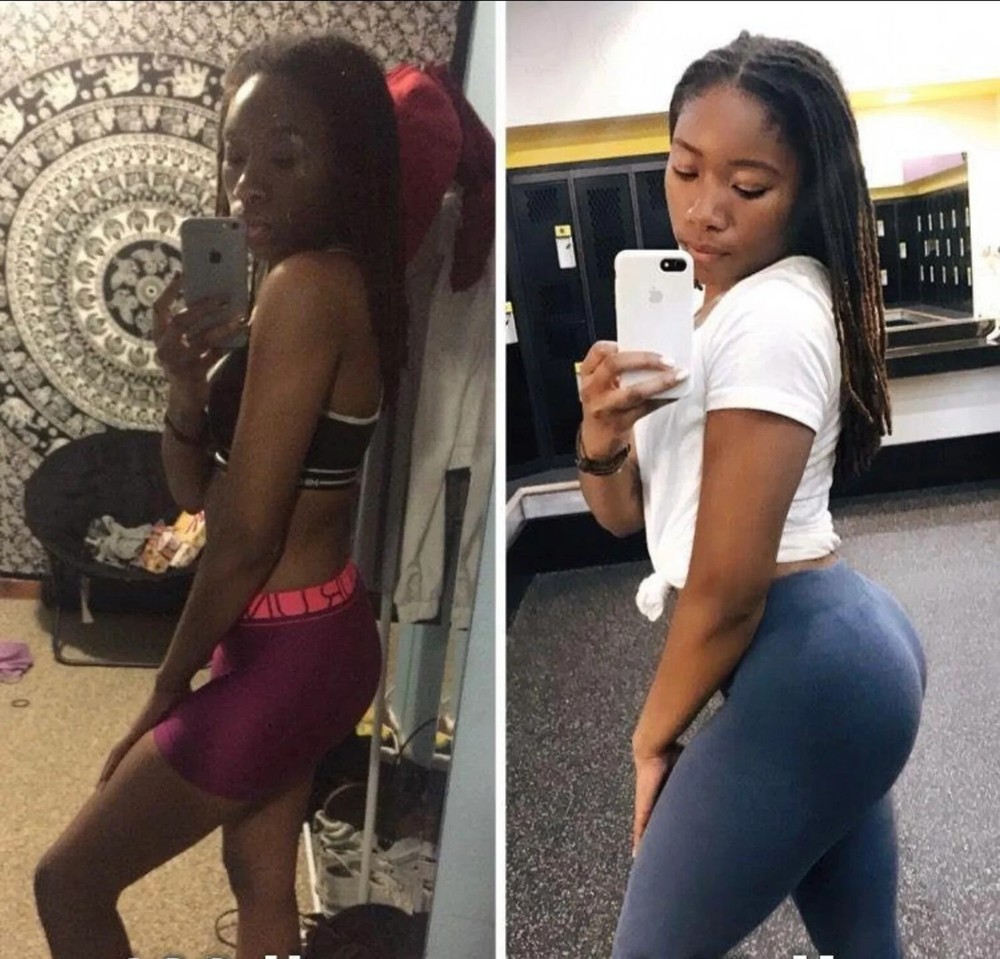 BBL Hips & Butt Enlargement bundle 7 days Results