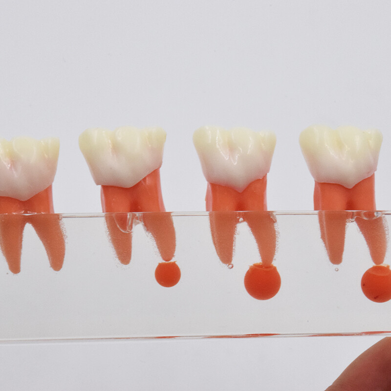 Dental Study Teaching Model Periodontal Caries Disease Teeth Dentoform Typodont