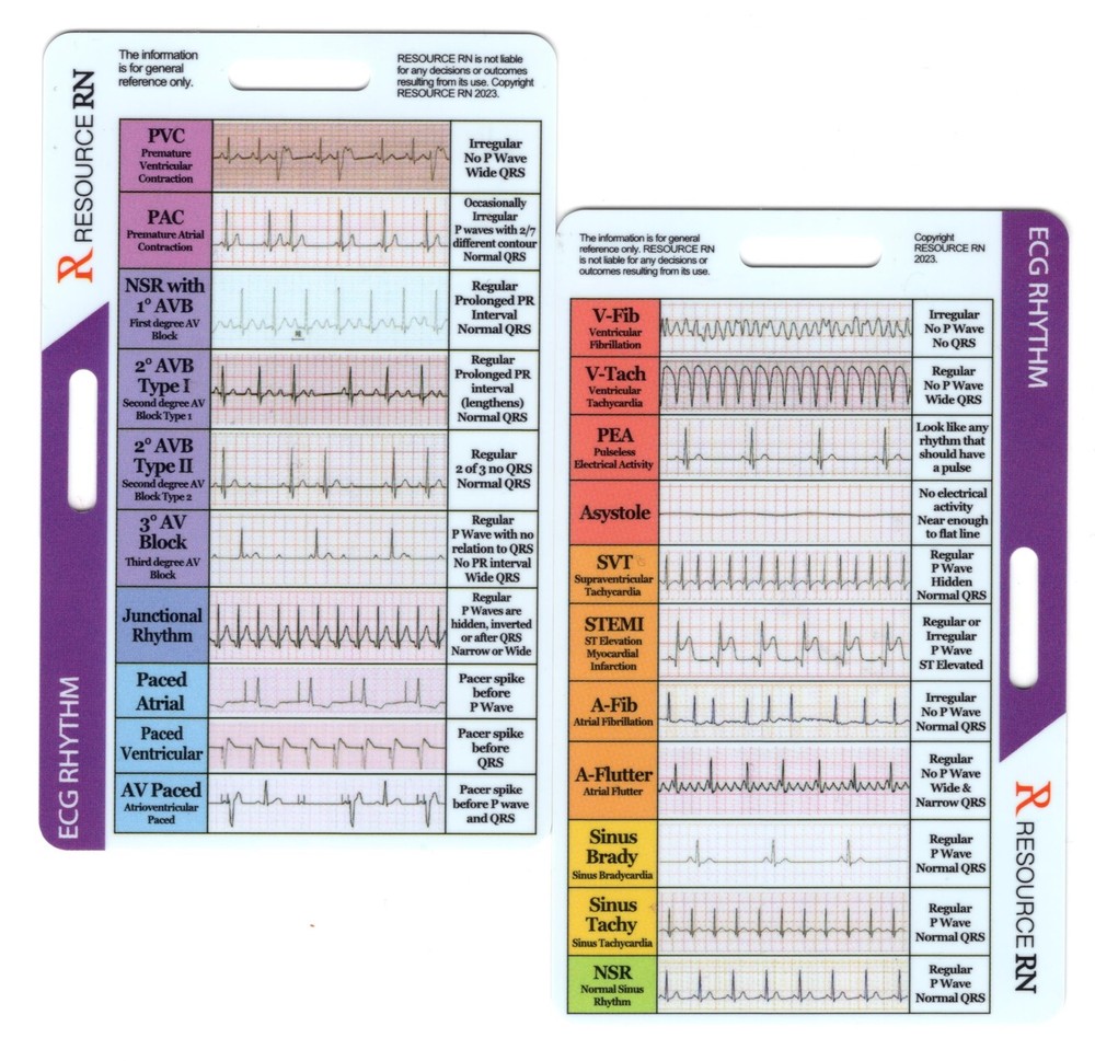 EKG Rhythm Interpretation - Compact & Portable Reference Card – Rapid Interpr...