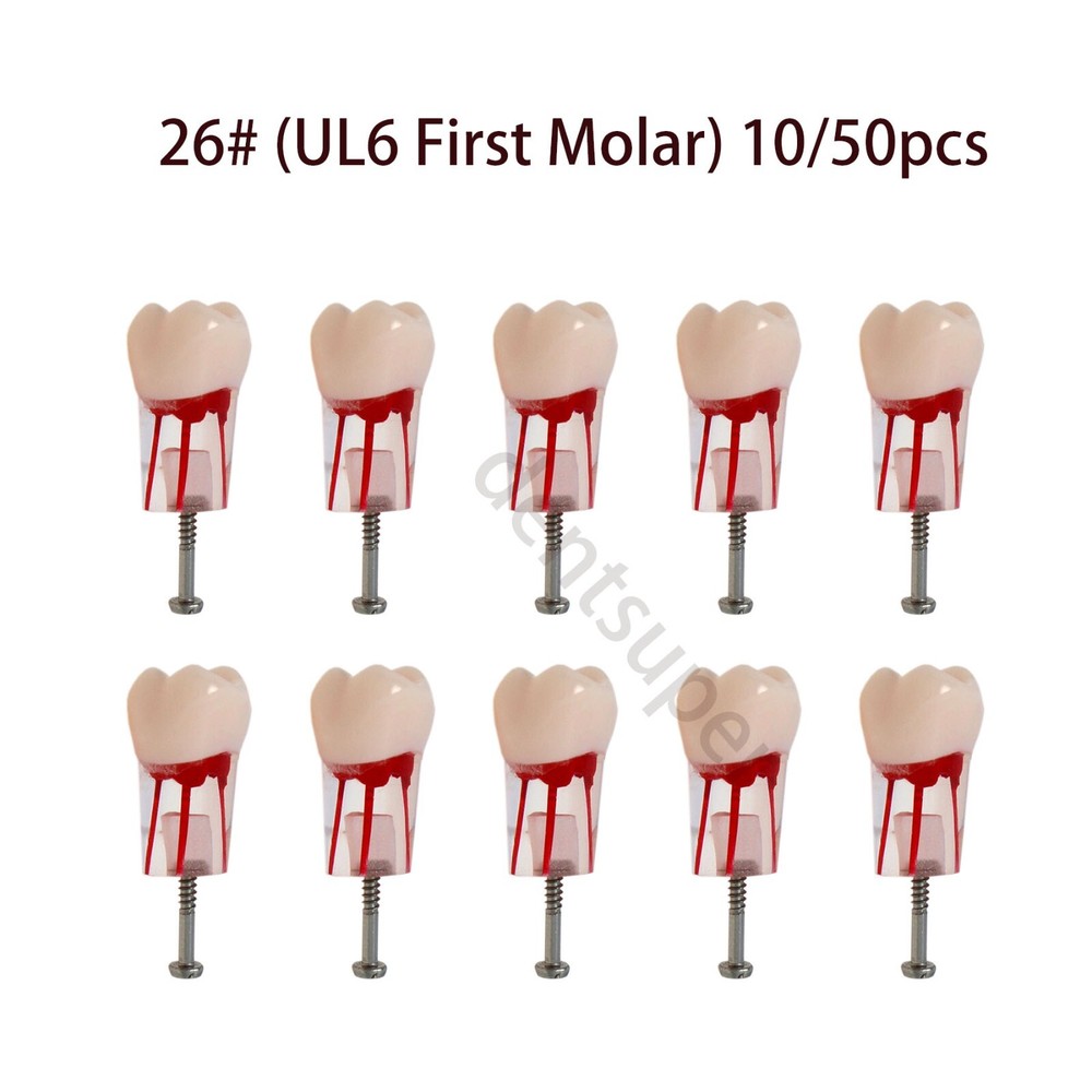26# (UL6 First Molar) Training Models for Root Canal Procedures Dental Endo Root