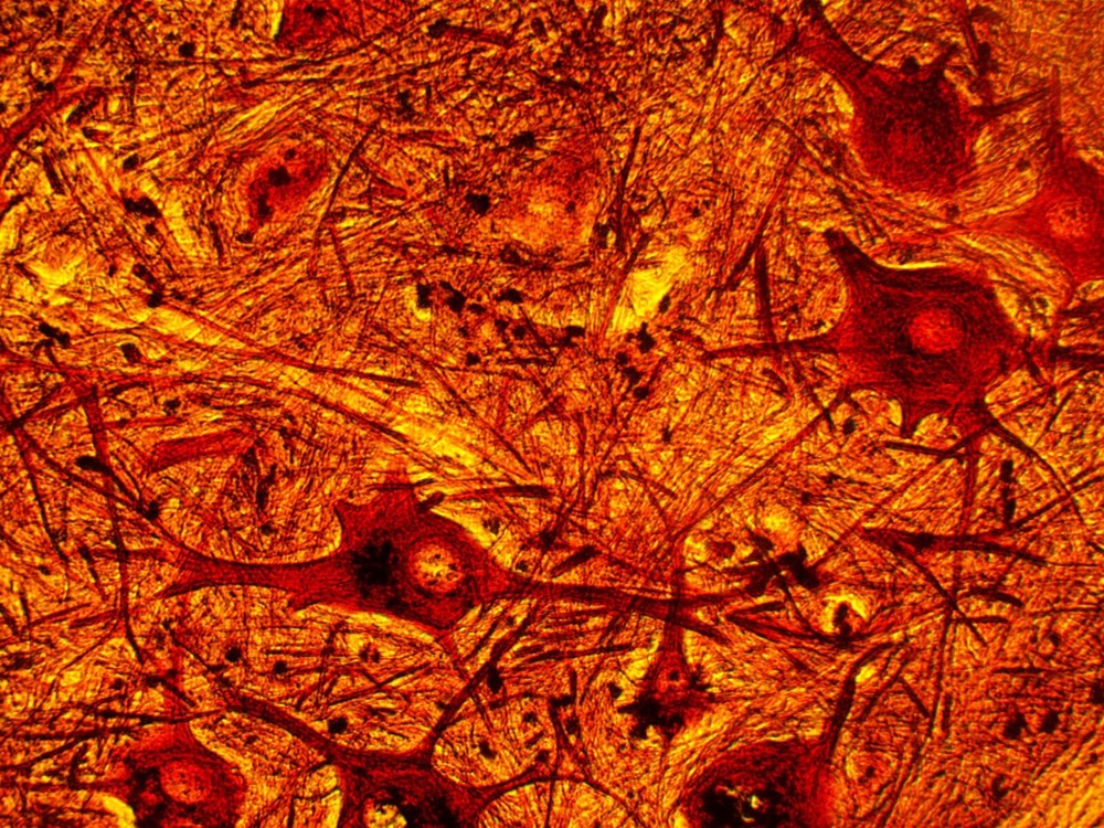 *Sale* Reconditioned AO Compound Microscope, 100X, 430X!