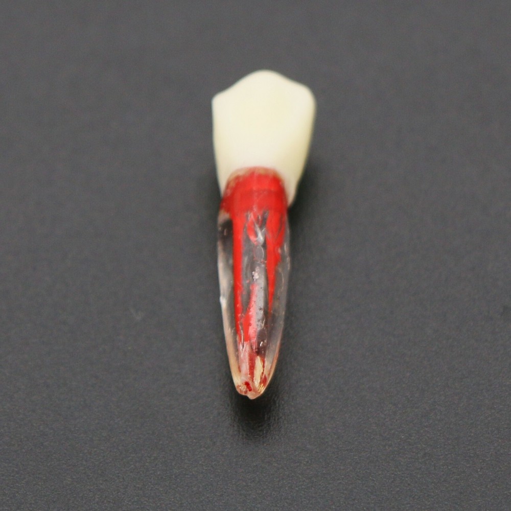 US Dental Root Canal Practice Model Teeth Pulp Study RCT Endo File 7 Sizes