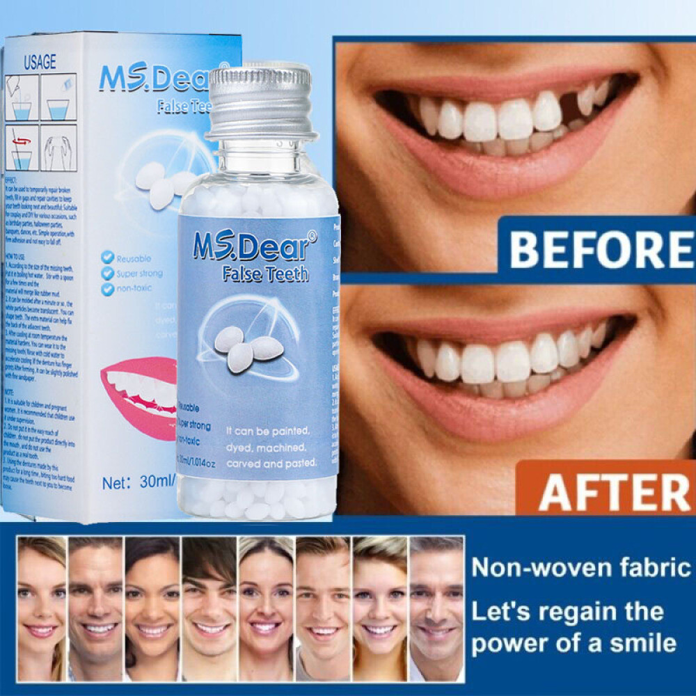 Resin False Teeth Solid Glue Moldable Teeth Gap Denture Temporary Tooth Repair