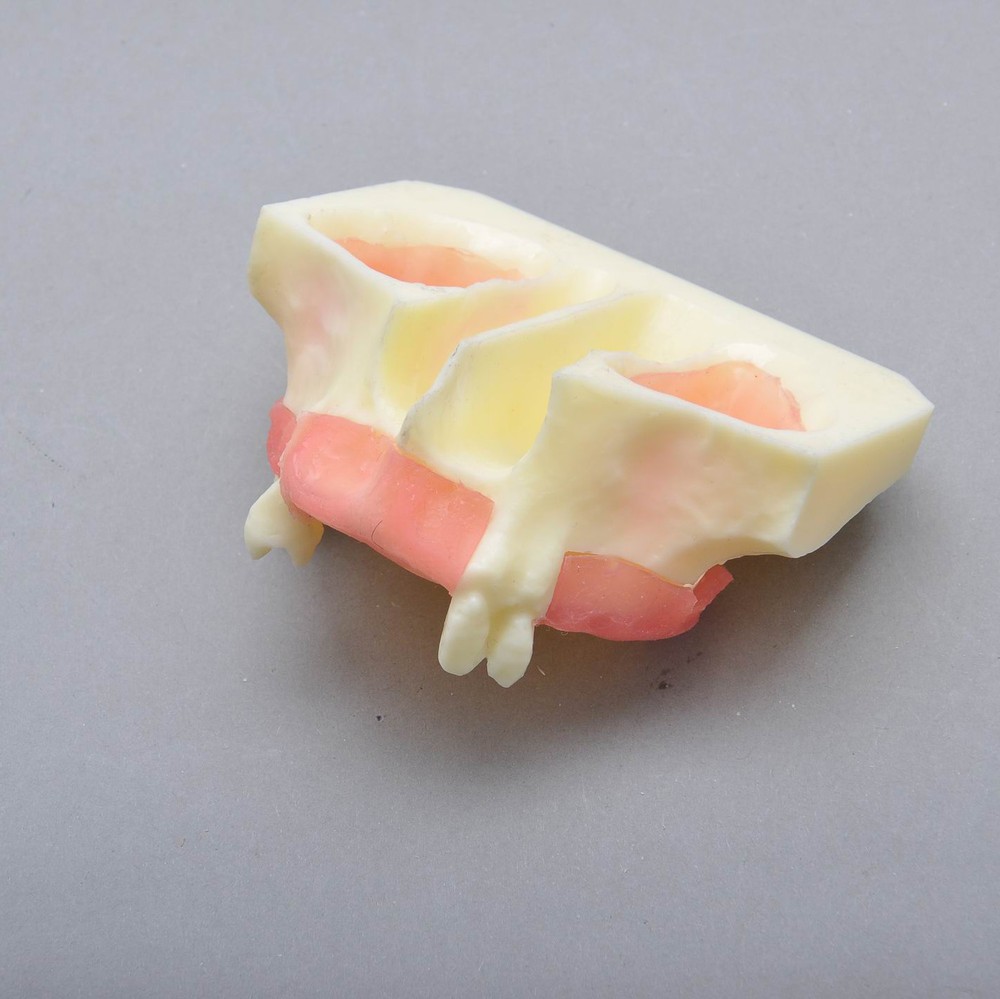 Dental Model #2013 01 - Sinus Lift Practice Model