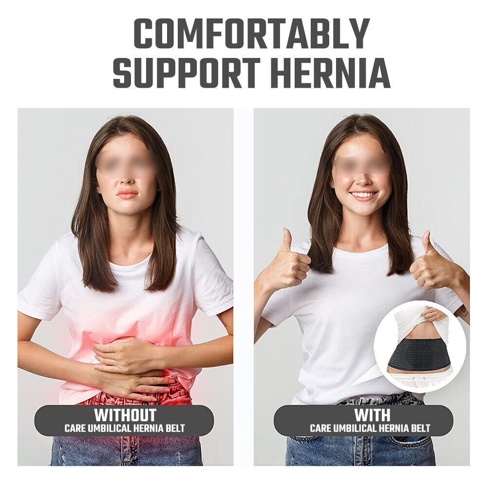 Umbilical Hernia Belt - Abdominal Support Binder with One Compression Pad Unisex