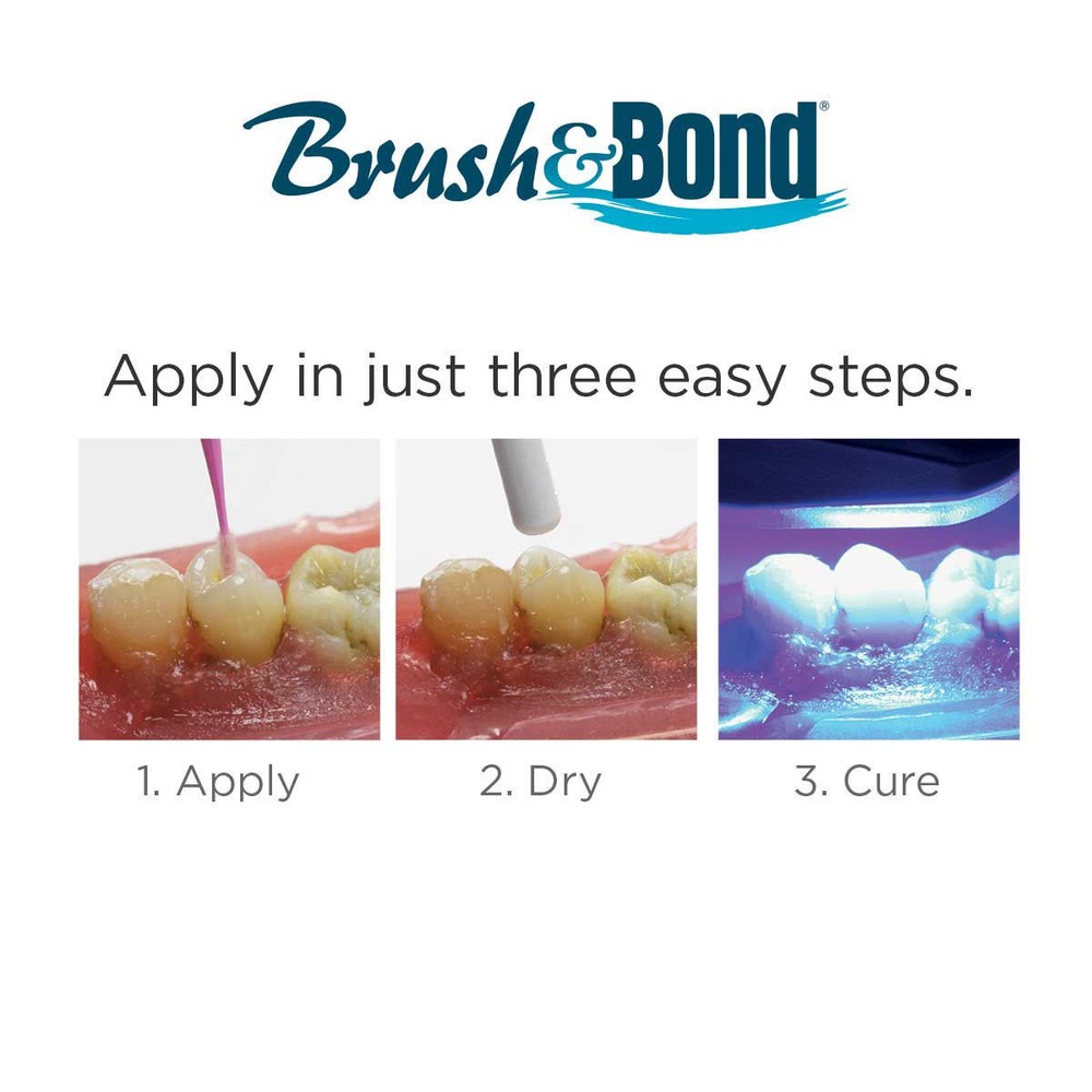 Parkell Brush & Bond Complete Kit Self-Etching Dentin Enamel Composite Ref# S284