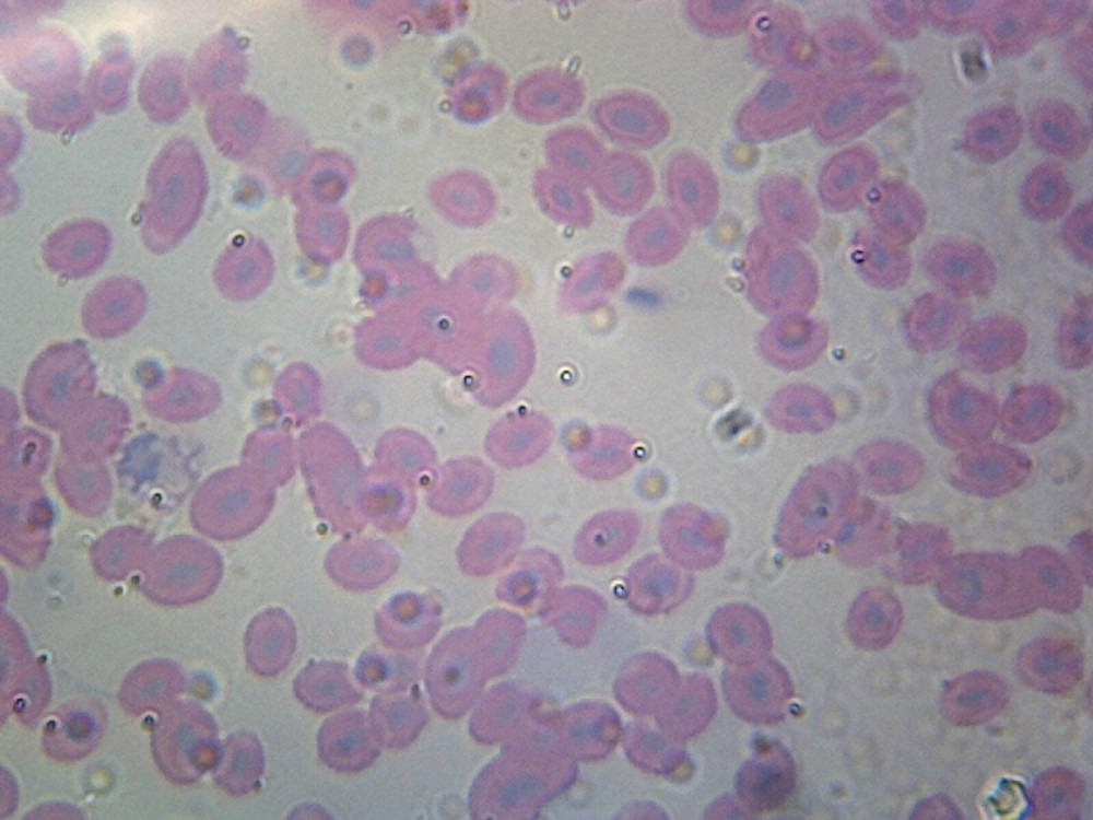 Fish Blood; Smear