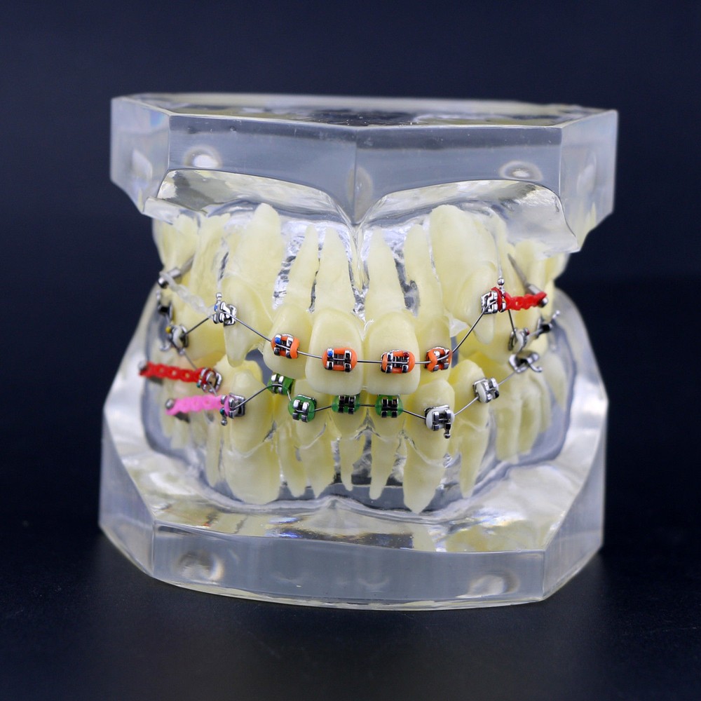 Dental Typodont Orthodontic Treatment Teeth Model Malocclusion Study w/ Bracket