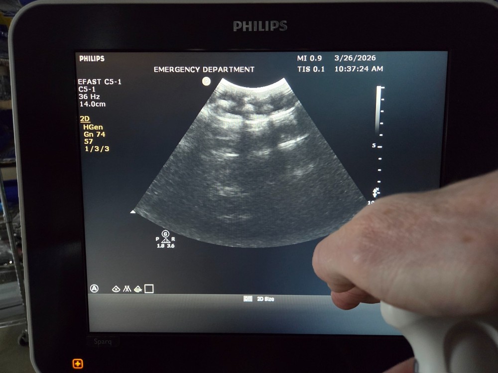 Philips C5-1 Curved Array Transducer - Working - Cord Damage