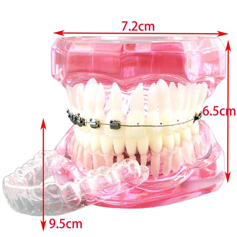 Dental Typodont Model Self-ligating Metal Bracket Ceramic Transparent Retainer