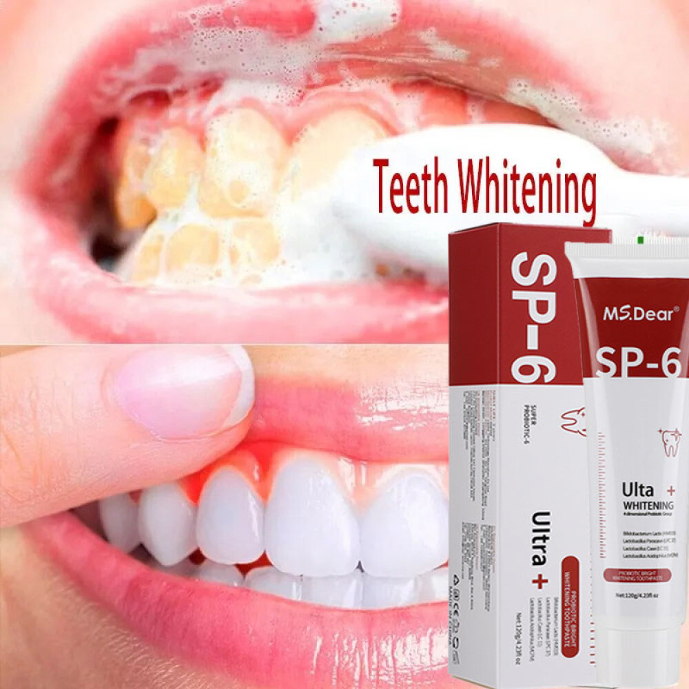 4~Sp-6 Probiotic Brightening Toothpaste, Deep Cleaning Care Whitening Toothpaste