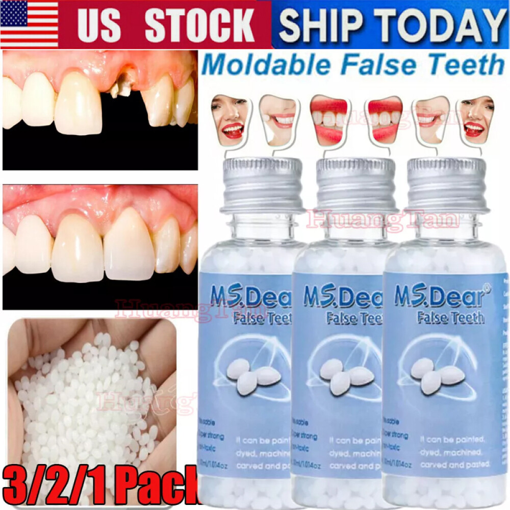 Teeth Repair Temporary Fix Kit Fitting Beads Reusable Fast Moldable False Tooth