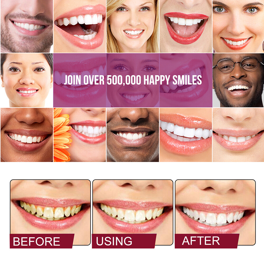 Sip-4 Toothpaste, Whitening Sp-4 Toothpaste, Sp-4 Probiotic Whitening Toothpaste
