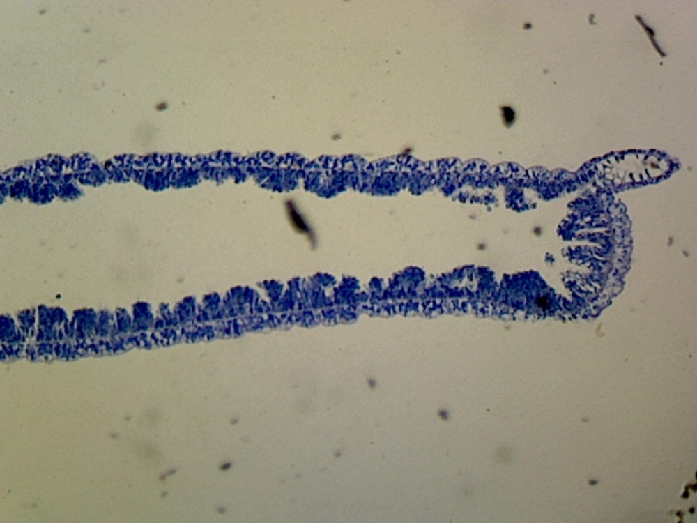 Hydra; Longitudinal Section; H&E Stain