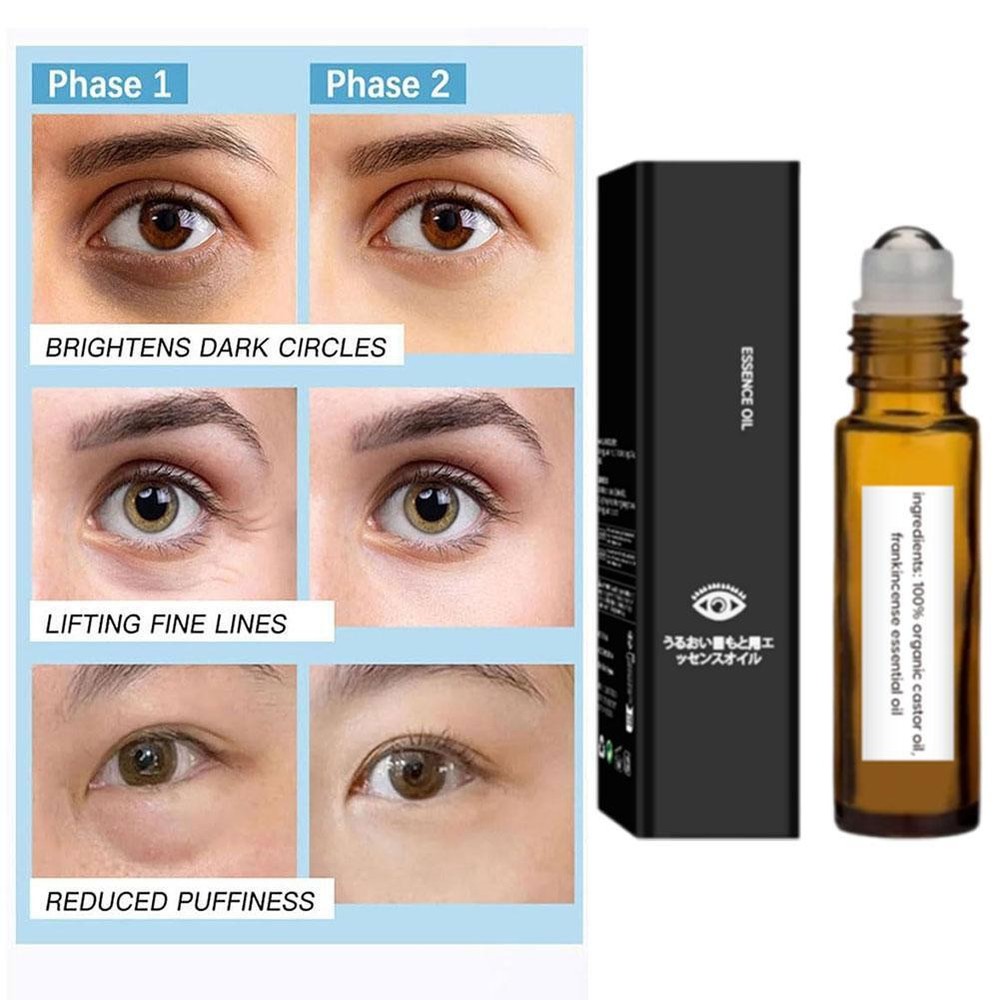 Rollerball Castor Oil and Frankincense,|us`