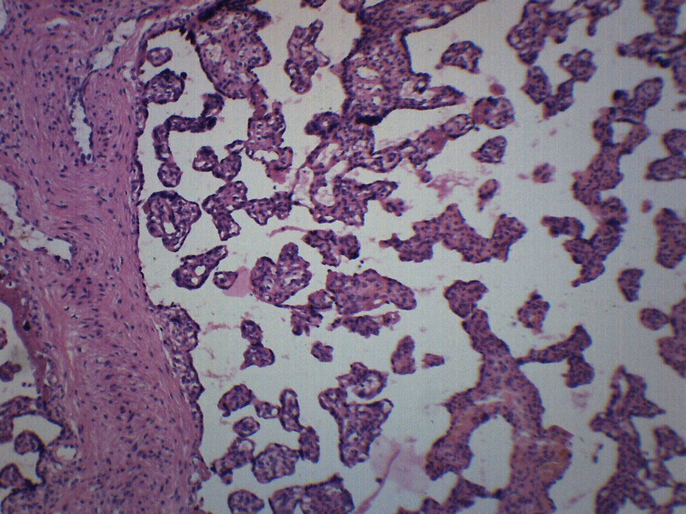 Human Placenta Section - Prepared Slide - 75x25mm - Eisco Labs