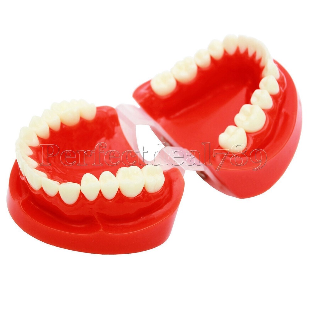 Dental Implant Study Model Analysis Demonstration Tooth Teaching Orthodontics