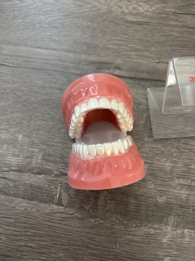 3M Clarity Aligner Typodont