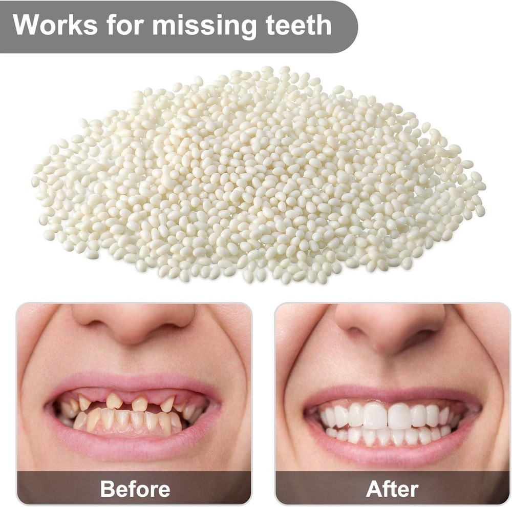 100g DIY Tooth Filler Kit - Temporary Solution for Missing and Broken Teeth