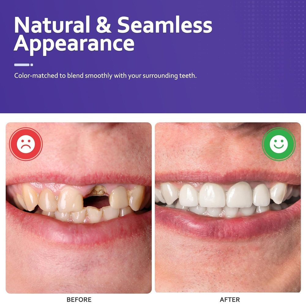 Custom Partial Dentures for Missing Teeth Removable Personalized Replacement Sol