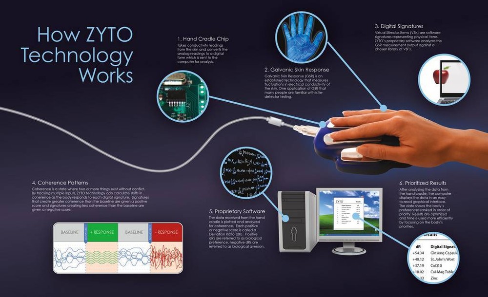ZYTO SELECT 5.0 SOFTWARE AND 2 HAND CRADLES