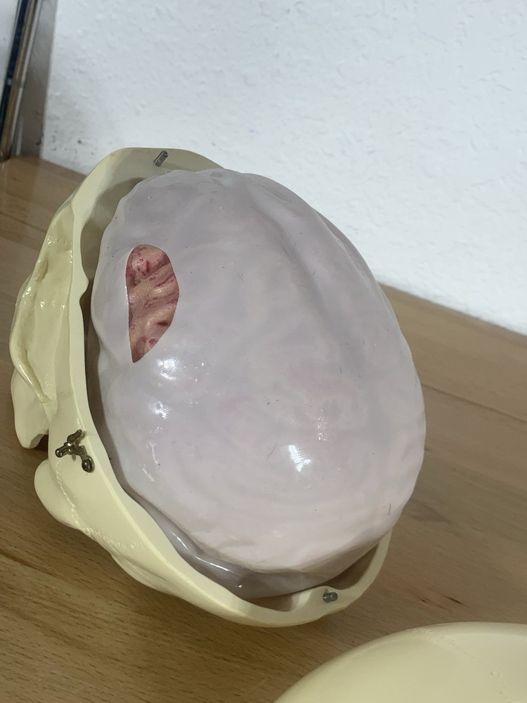 Anatomically Correct Life Size Skull Removable Cranium & Brain Teaching Aid
