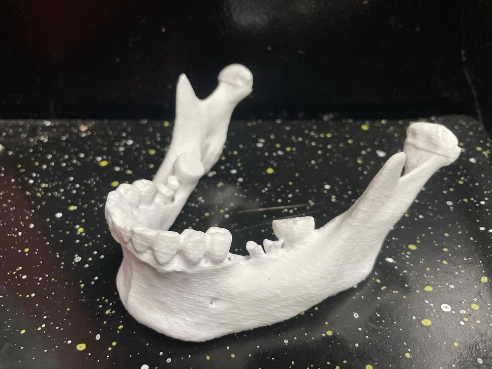 3D PRINTED HUMAN 3d JAW BONE