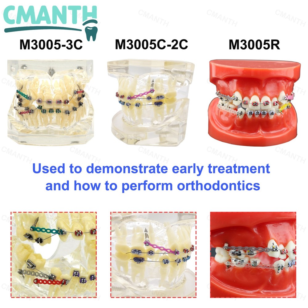 Dental Model Ceramic Brackets Orthodontic Correction Teaching Model M3005