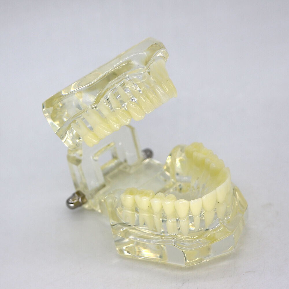 1×Transparent Plastic Study Teeth Model Demonstrate Comprehensive Repair Yellow