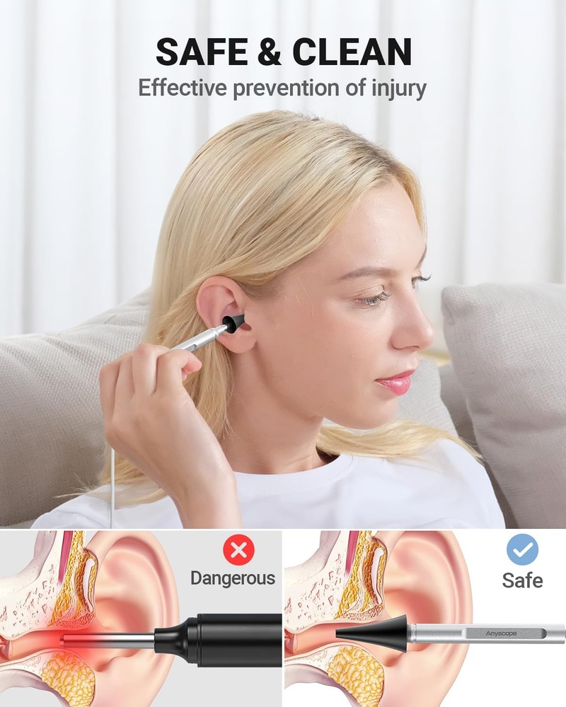 AnyScope Digital Otoscope Compatible with iPhone and Android Devices, HD Ear ...