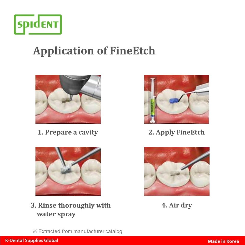 Spident FineEtch(37% Etching Gel) 5ml x 3ea