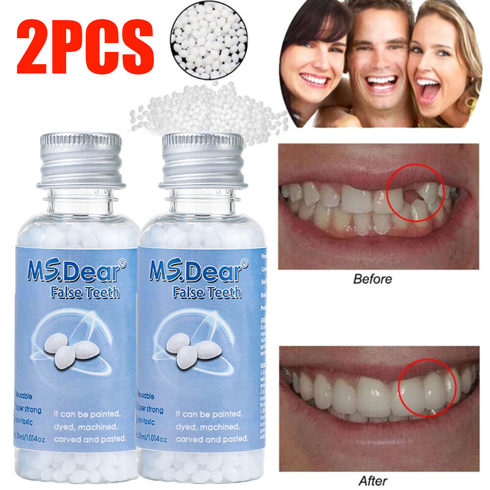 2X Tooth Repair Kit - Temporary Teeth Replacement Kit for Missing & Broken Teeth