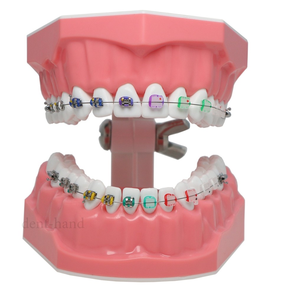Dental Typodont Teeth Model 1:1 Teach Study Half Metal Ceramic Brackets Tubes