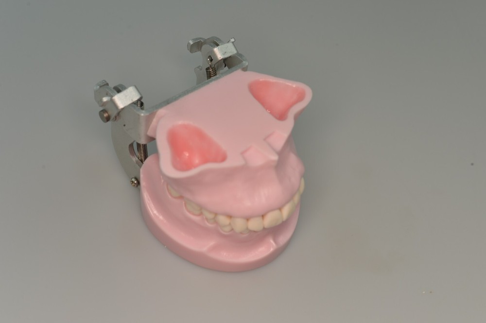 Dental Typodont Orthodontic Model Teeth Anchorage Implant Training Practice