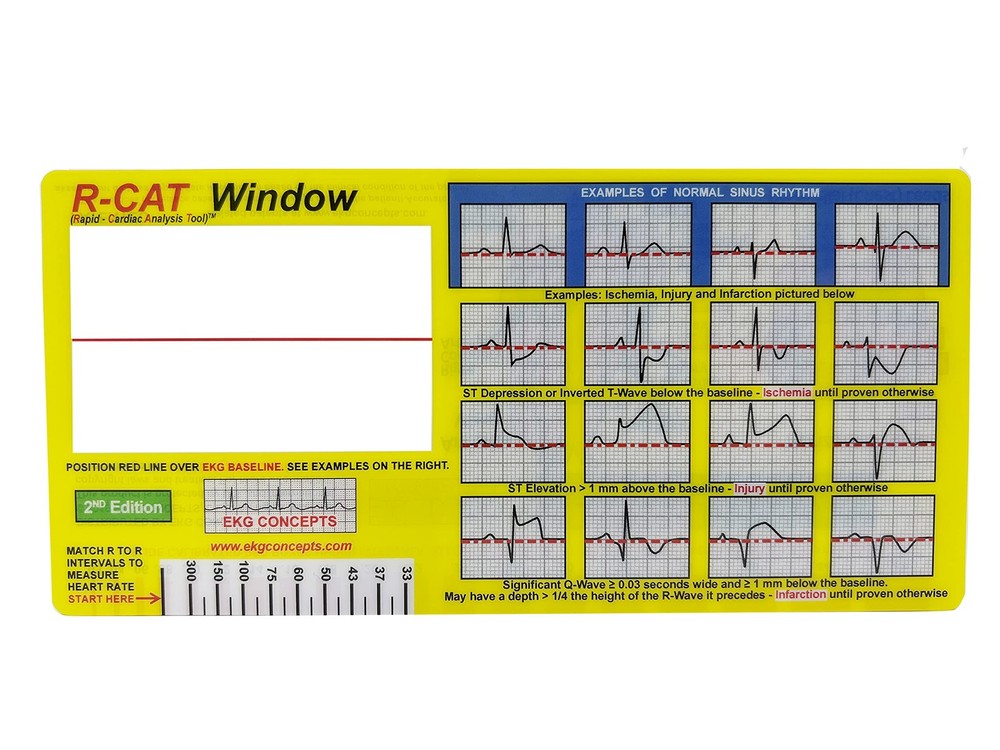 R-CAT EKG Window 2nd Edition