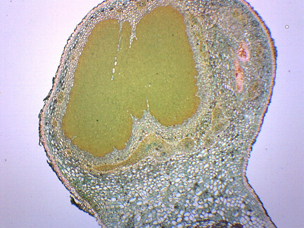 Legume Root Nodule - Prepared Microscope Slide - 75x25mm - Eisco Labs