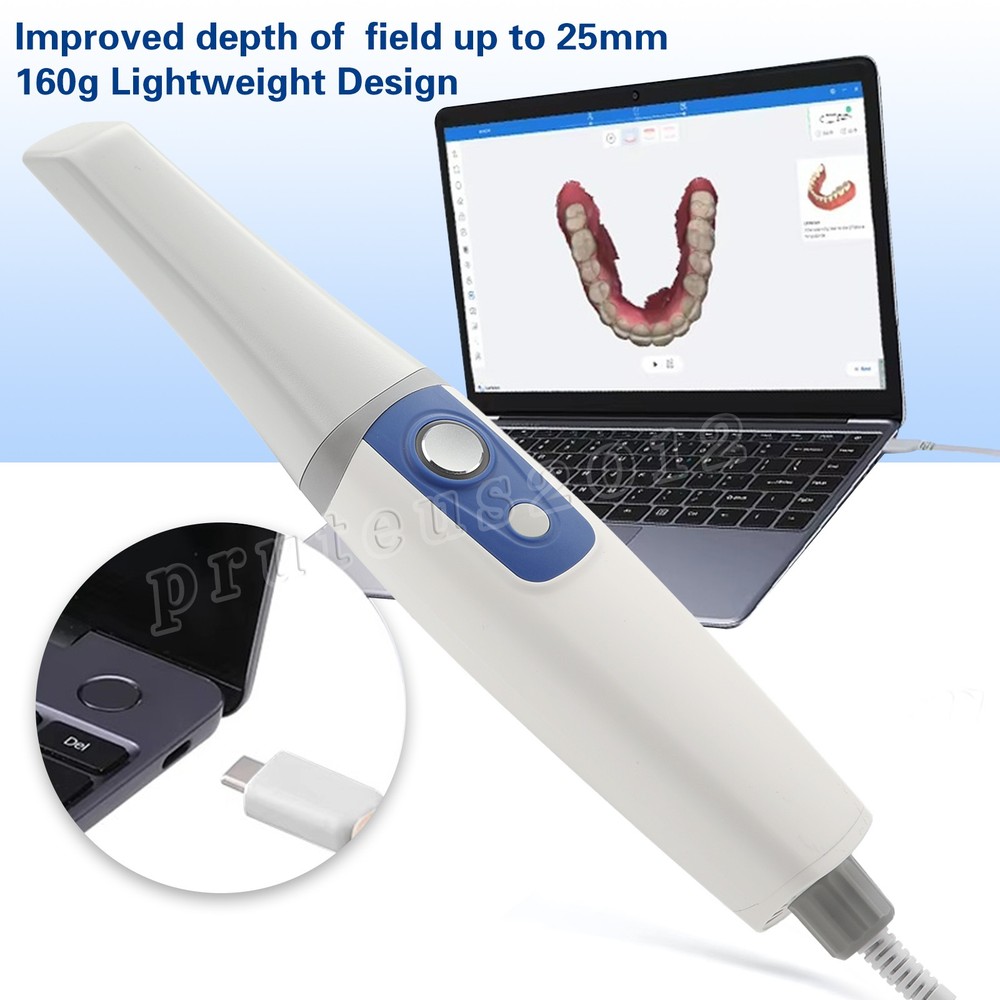 dental 3d scanner 3D Intraoral Scanner