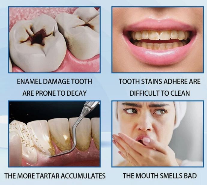 3 packs - 7.5% Hydroxyapatite Toothpaste Remove Yellow Tooth Stains