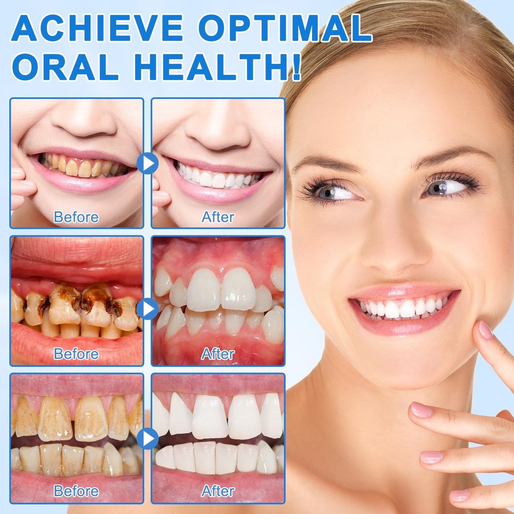 9.9% Hydroxyapatite Toothpaste Nano Hydroxyapatite Toothpaste Protects Enamel...
