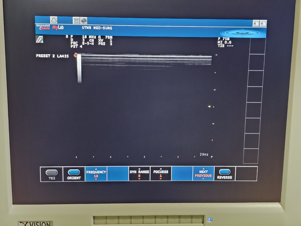 Esaote LA435 Linear Array Ultrasound Transducer Ref 9600173000