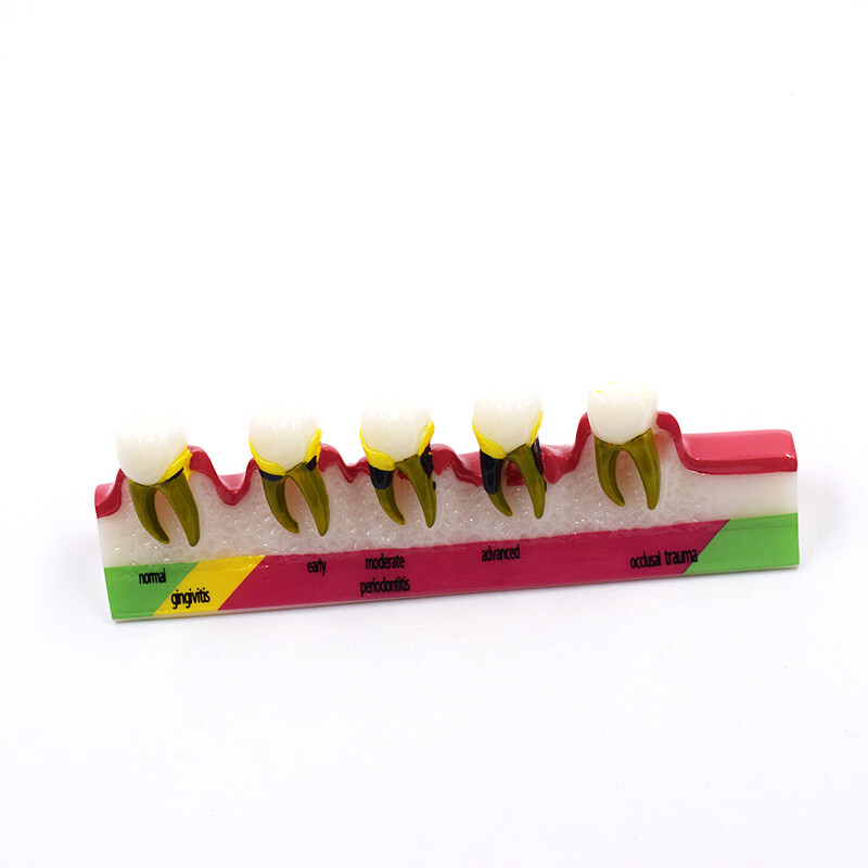 Dental High Quality Assort Dentoform Pathological Study Periodontal Model Teeth
