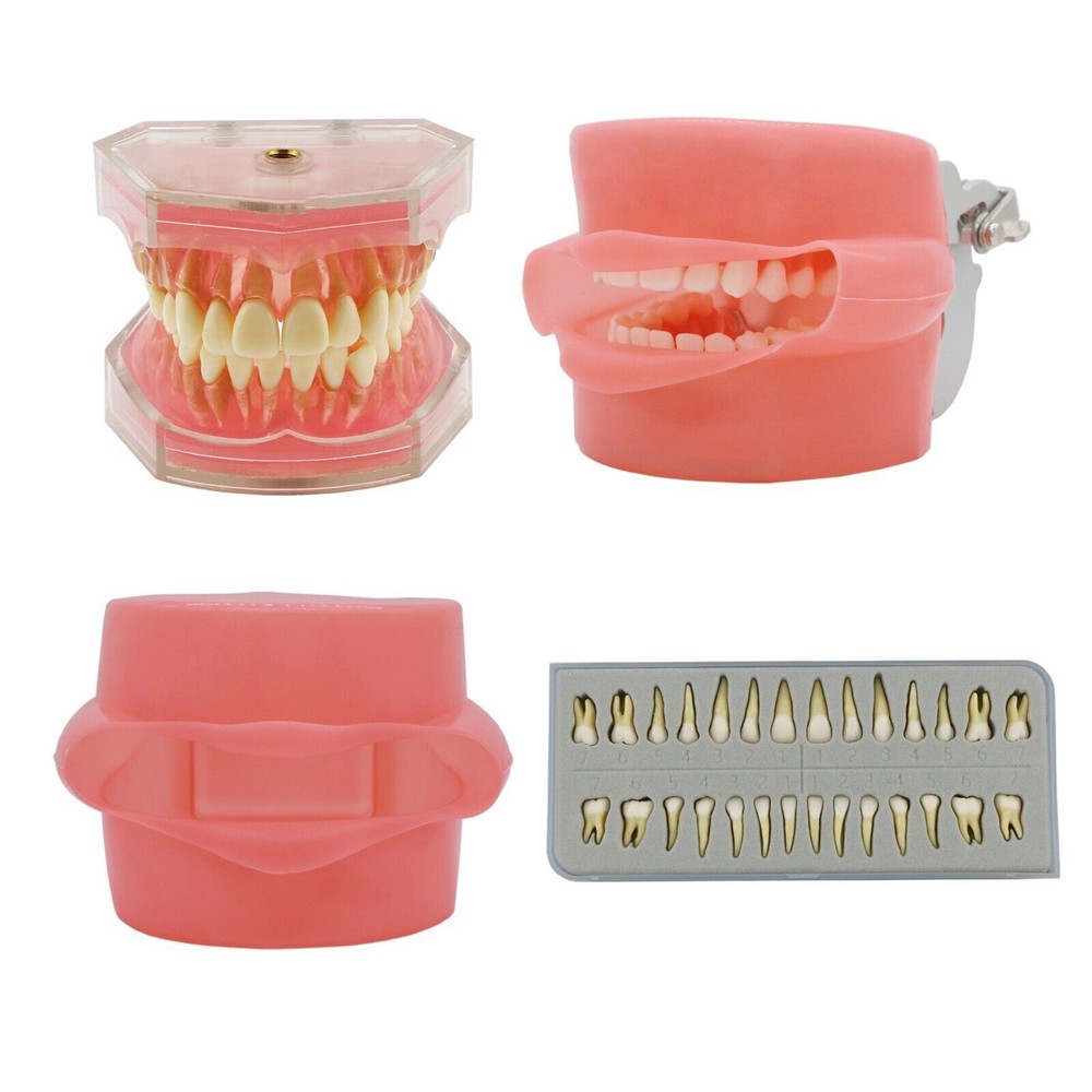 Dental Multiple Types Teaching Teeth Model Typodont Ortho Implant Practice Demo
