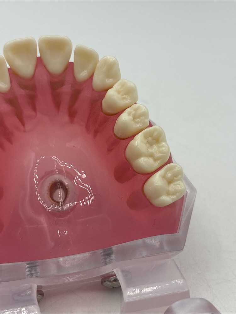 Dental Typodont Practice Removable Teeth Model M7008