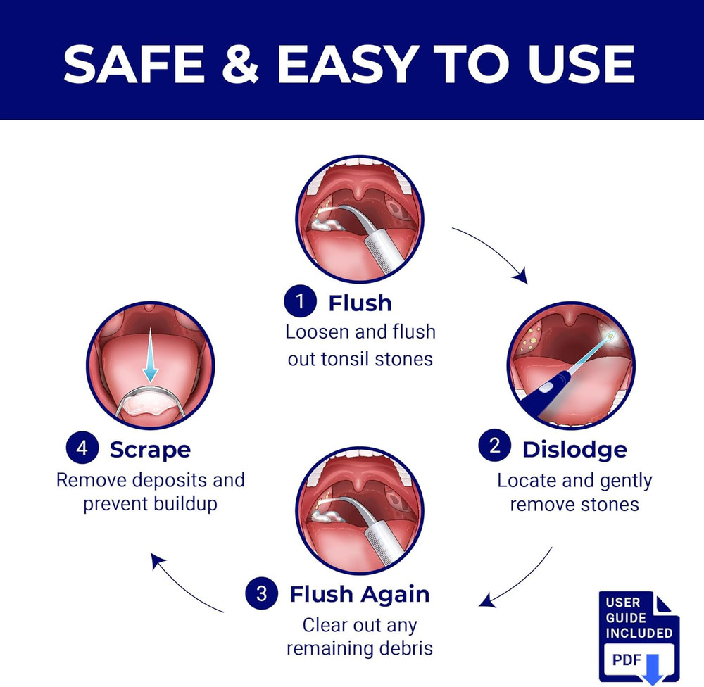 Tonsil Stone Remover - Tonsil Stone Removal Kit - Tonsillolith Remover...
