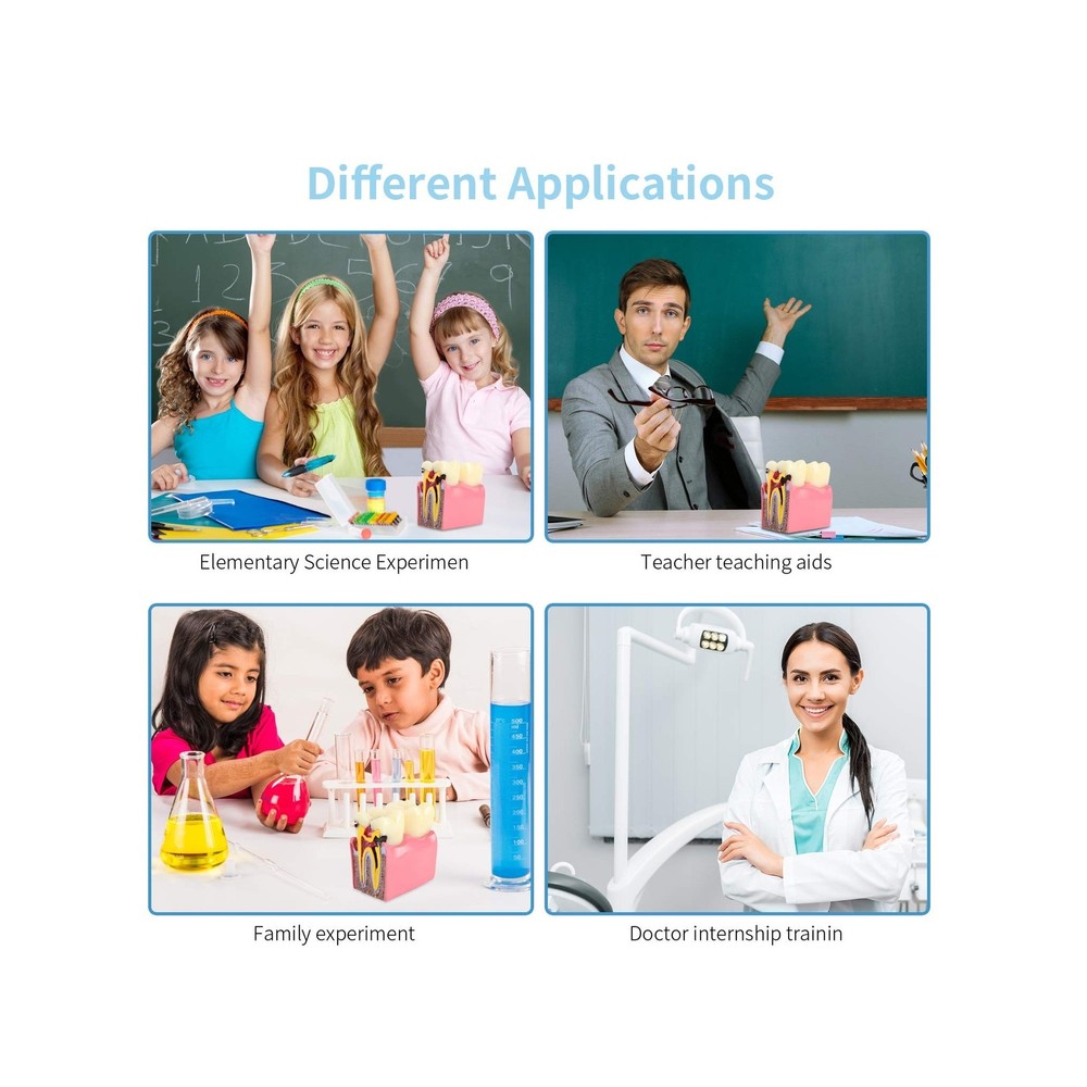 Dental Caries Tooth Model 6 Times Decay Teeth Comparative Study Model, Caries...